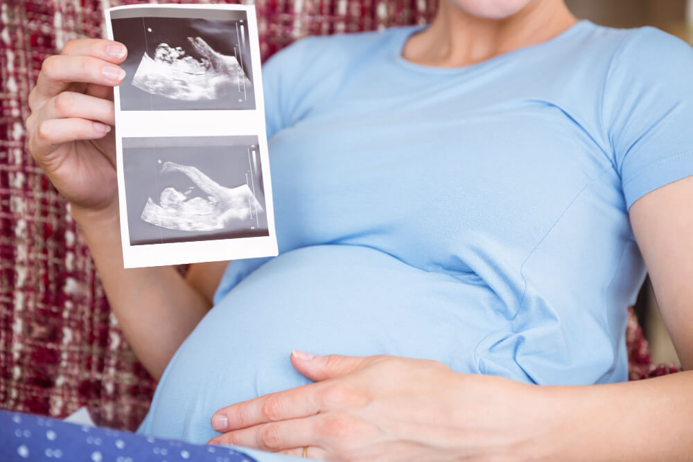 Gender Reveal Ultrasound 13–20 Weeks ab