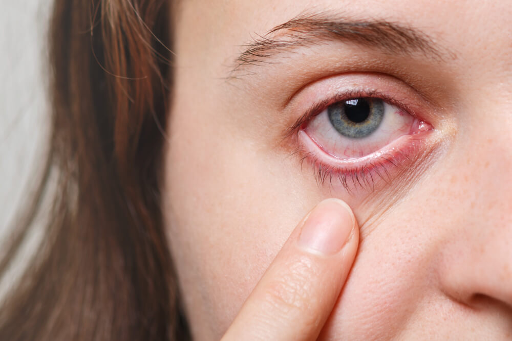 Retinal Tears and Retinal Detachment